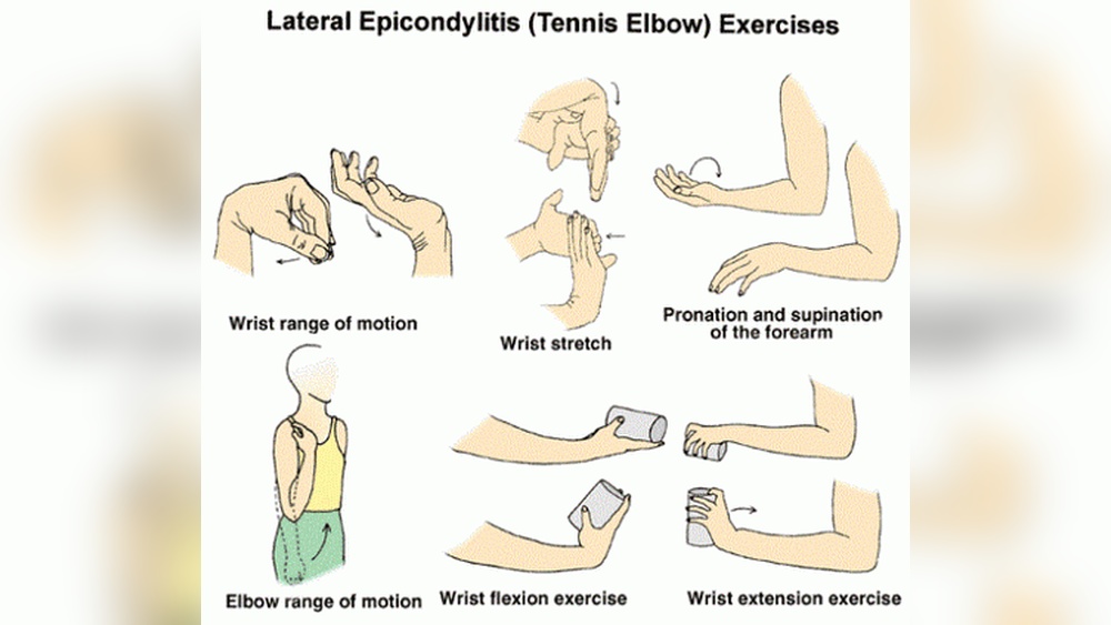 How to Prevent Tennis Elbow in Pickleball
